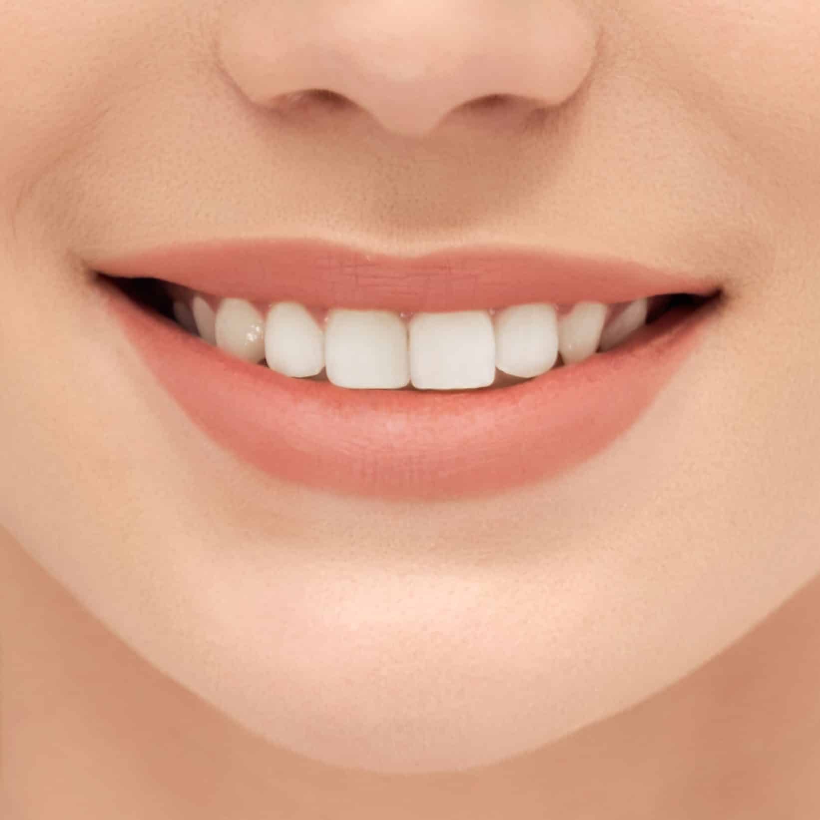 composite bonding shrewsbury